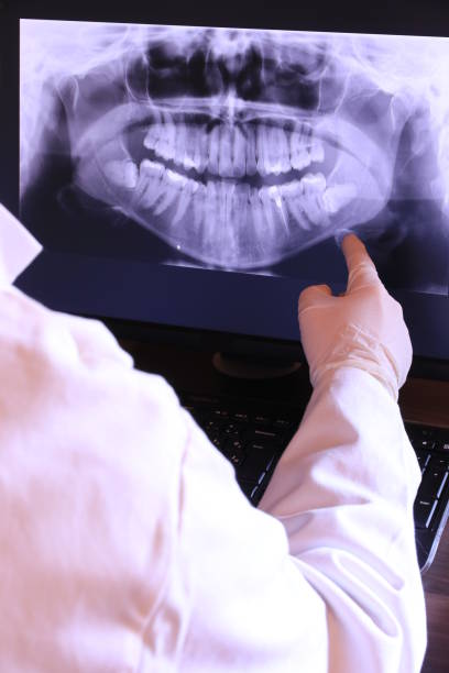 Best Chipped Tooth Repair Near Me  in Lodi, WI