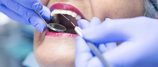 Best Chipped Tooth Repair Near Me  in Lodi, WI